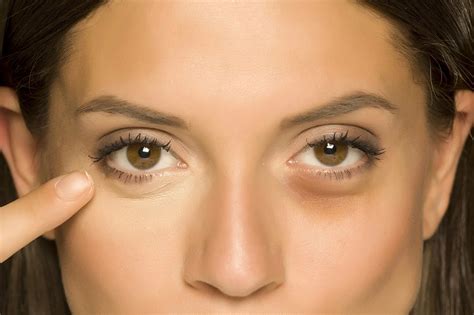 how to fake bags under your eyes|puffy eyes under bags.